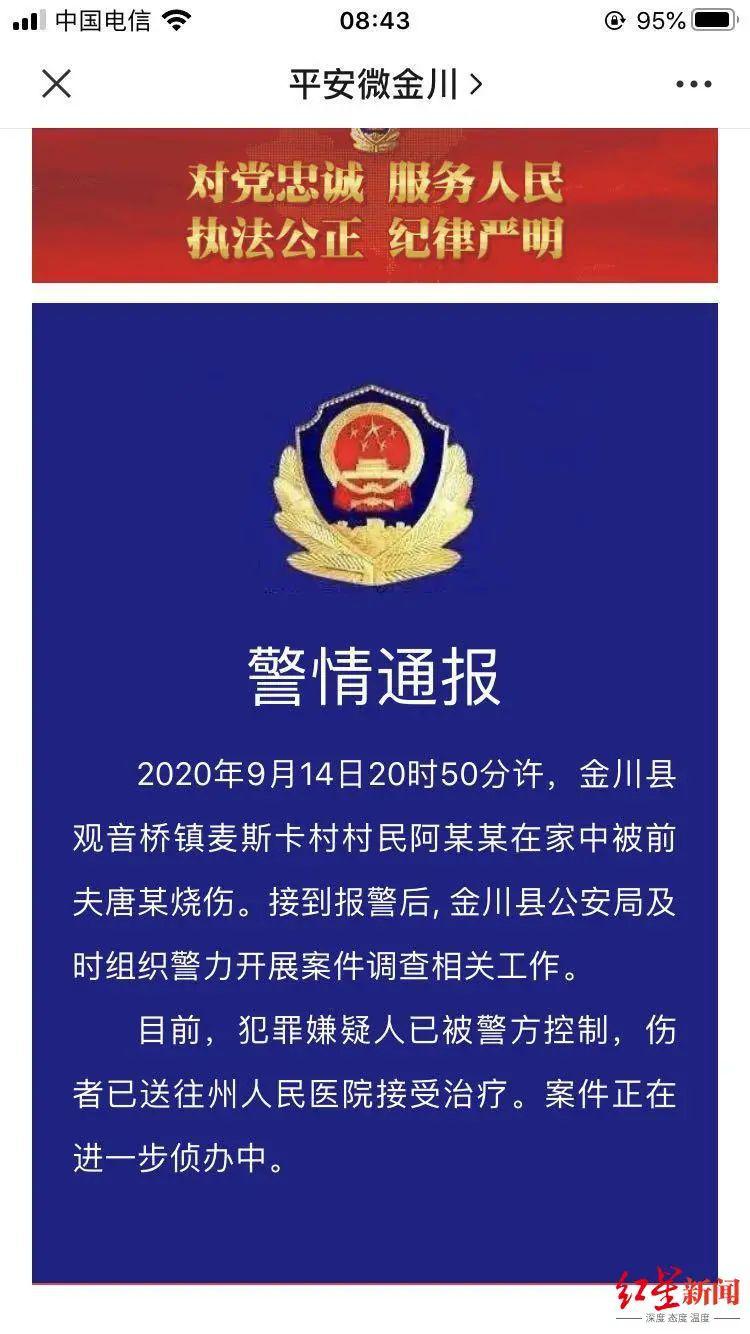 令人发指！网红女主播直播时，被前夫用汽油烧成重伤