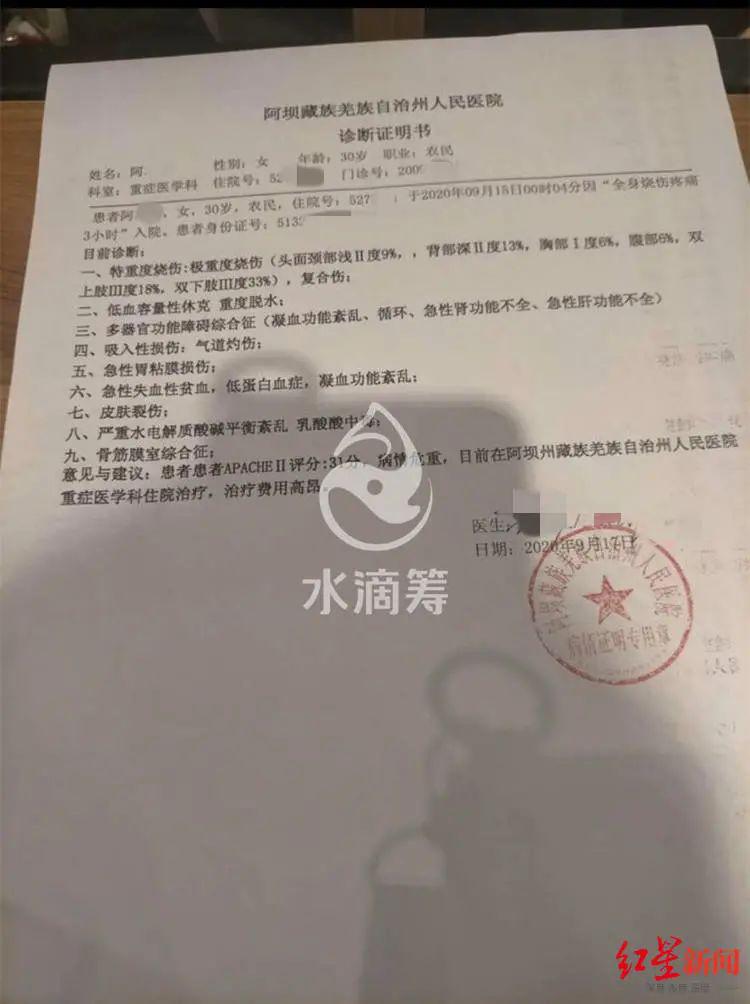 令人发指!网红女主播直播时,被前夫用汽油烧成重伤插图2 令人发指!网红女主播直播时,被前夫用汽油烧成重伤