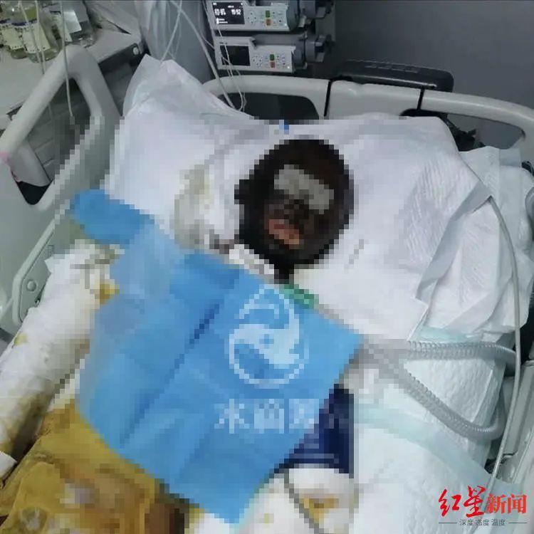 令人发指!网红女主播直播时,被前夫用汽油烧成重伤插图3 令人发指!网红女主播直播时,被前夫用汽油烧成重伤
